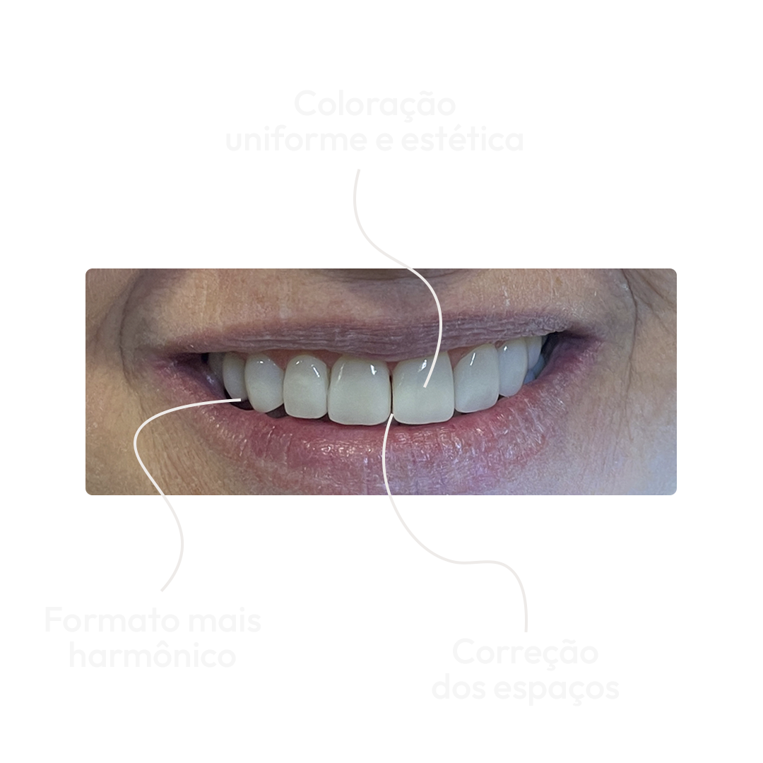 Depois